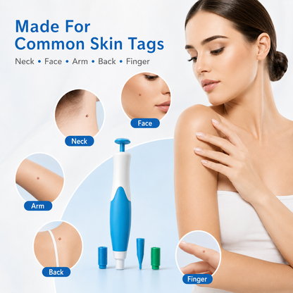 🩹 Skin Tag Removal Kit – 2-in-1 Auto Band Applicator with Dual Size Options for At-Home Use