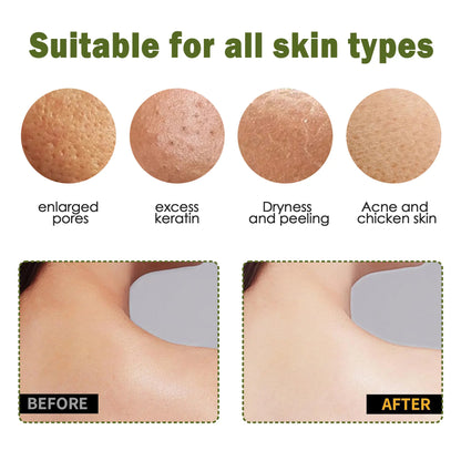 🧤 Exfoliating Gloves – Instantly Remove Dead Skin