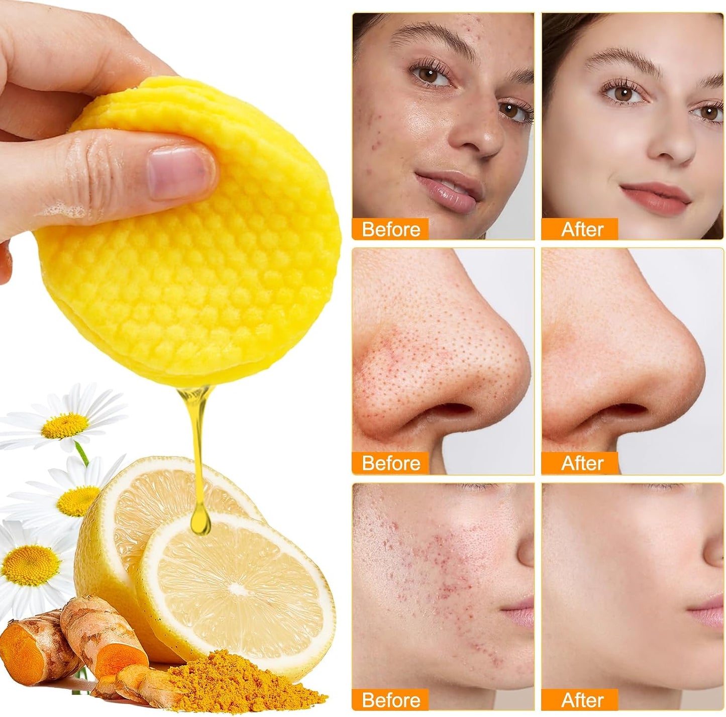 ✨🍃Turmeric + Kojic Brightening Pads – Pore Clean, Oil Balance, Glow On