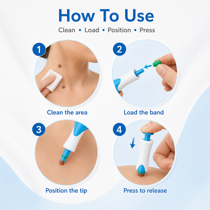 🩹 Skin Tag Removal Kit – 2-in-1 Auto Band Applicator with Dual Size Options for At-Home Use