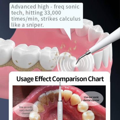 🦷✨Ultrasonic Dental Plaque Remover for Tartar & Stain Care