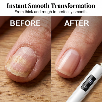 💅 Electric Nail Grinder – Transform Thick Rough Nails